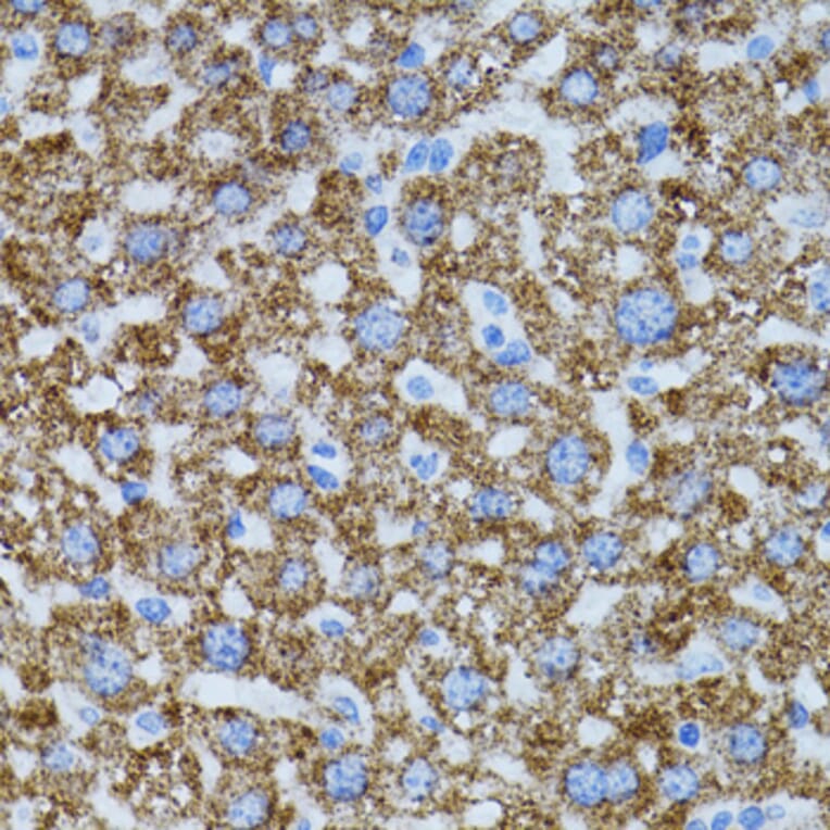 Immunohistochemistry - Anti-CAT Antibody (A5275) - Antibodies.com