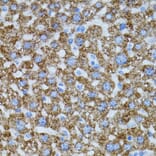 Immunohistochemistry - Anti-CAT Antibody (A5275) - Antibodies.com