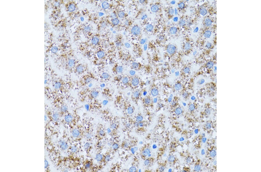 Immunohistochemistry - Anti-CAT Antibody (A5275) - Antibodies.com