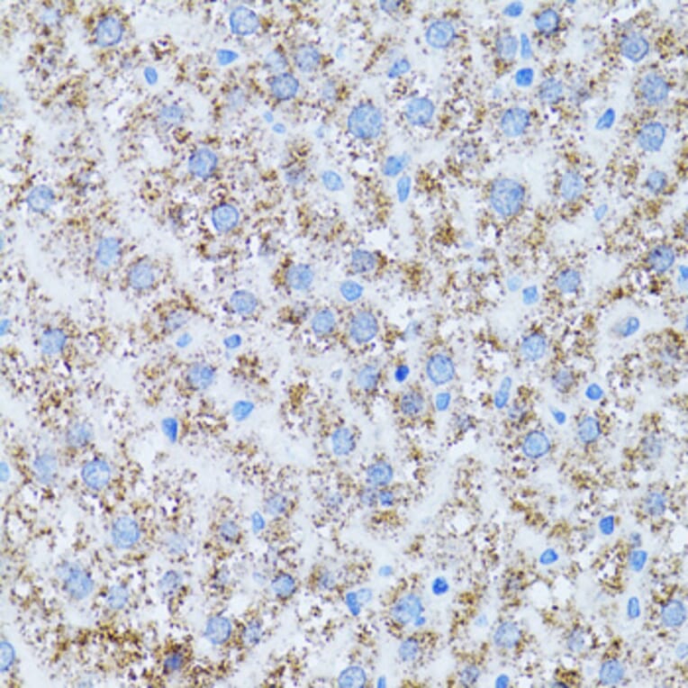 Immunohistochemistry - Anti-CAT Antibody (A5275) - Antibodies.com