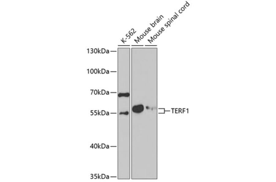 Western Blot - Anti-TERF1 Antibody (A5293) - Antibodies.com
