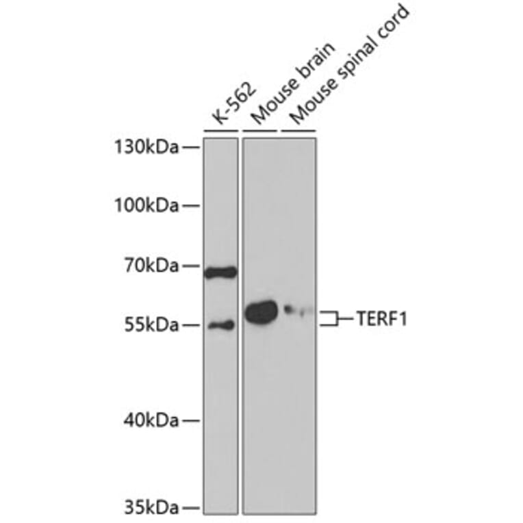 Western Blot - Anti-TERF1 Antibody (A5293) - Antibodies.com