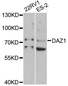 Western blot analysis of extracts of various cell lines, using Anti-DAZ1 Antibody (A5310) at 1:1,000 dilution.
Secondary antibody: Goat Anti-Rabbit IgG (H+L) (HRP) (AS014) at 1:10,000 dilution.
Lysates / proteins: 25µg per lane.
Blocking buffer: 3% non-fat dry milk in TBST.
Detection: ECL Basic Kit (RM00020).
Exposure time: 90s.