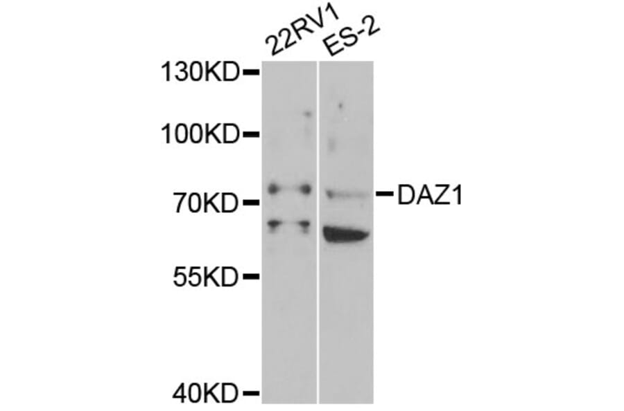 Western Blot - Anti-DAZ1 Antibody (A5310) - Antibodies.com