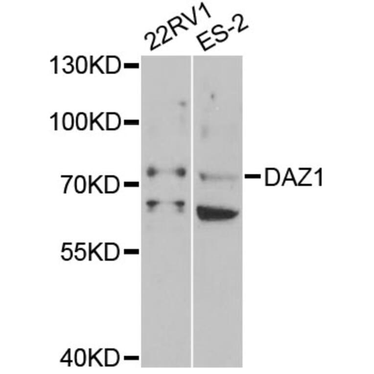 Western Blot - Anti-DAZ1 Antibody (A5310) - Antibodies.com