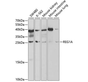 Western Blot - Anti-REG1A Antibody (A5327) - Antibodies.com