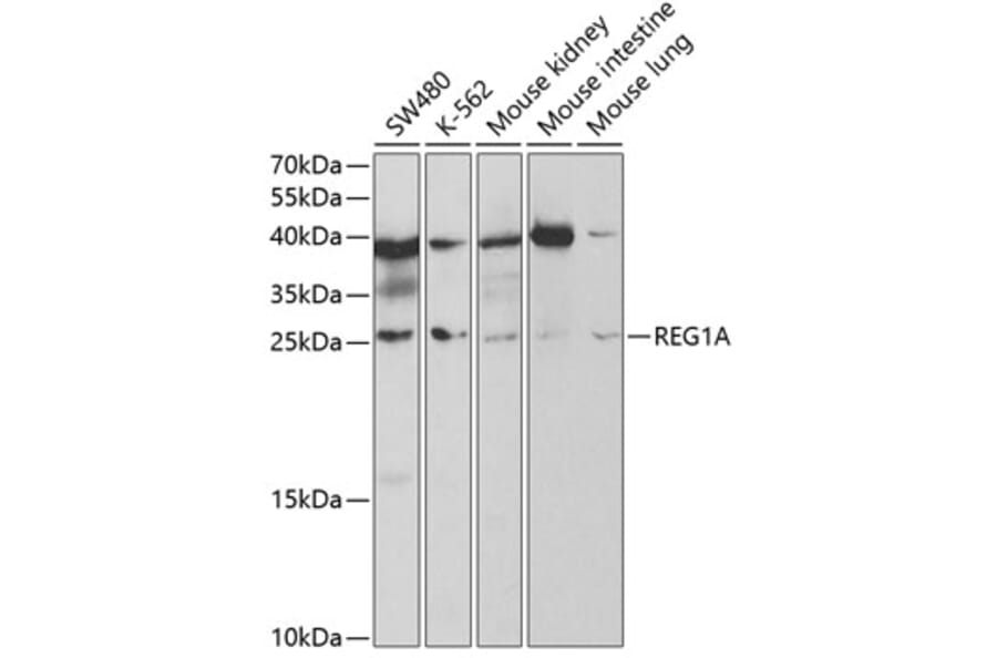 Western Blot - Anti-REG1A Antibody (A5327) - Antibodies.com