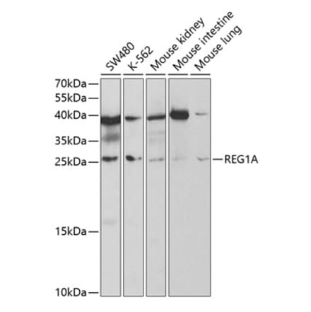 Western Blot - Anti-REG1A Antibody (A9700) - Antibodies.com