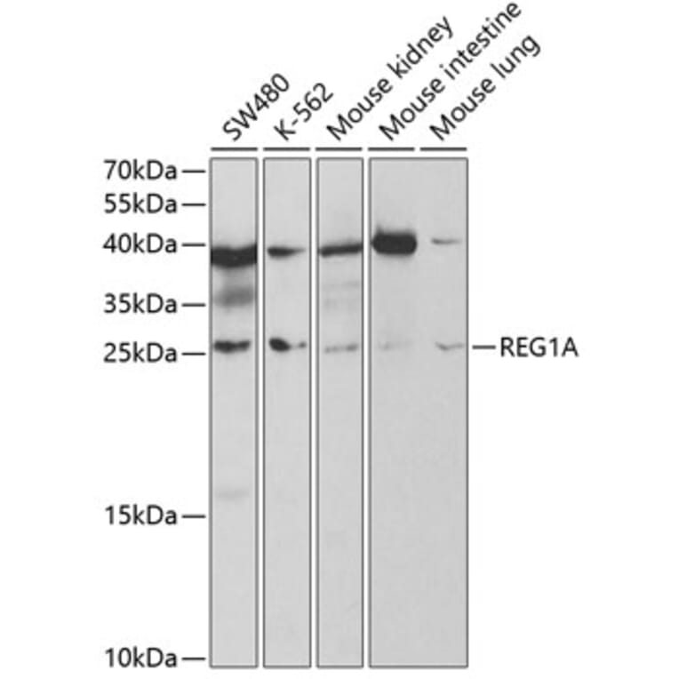 Western Blot - Anti-REG1A Antibody (A5327) - Antibodies.com