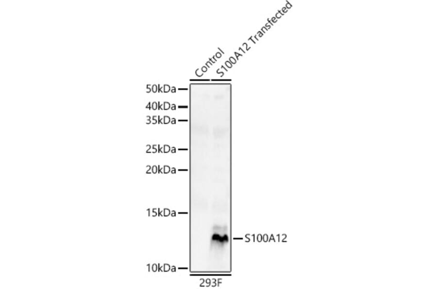 Western Blot - Anti-S100A12/CGRP Antibody (A9701) - Antibodies.com