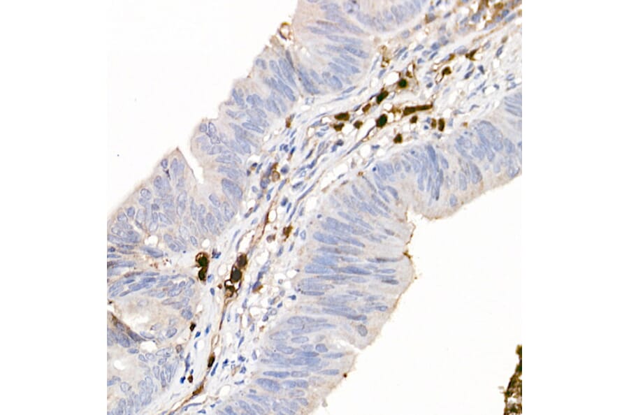 Immunohistochemistry - Anti-S100A12/CGRP Antibody (A9701) - Antibodies.com