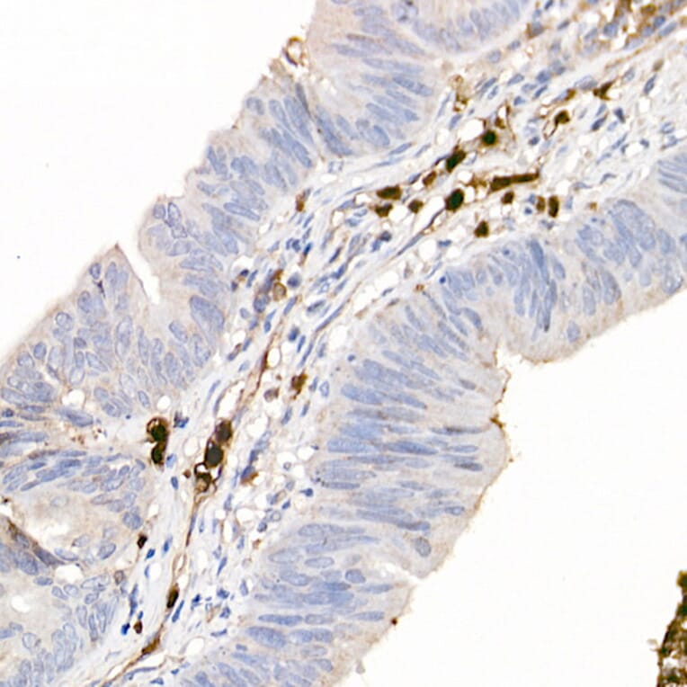 Immunohistochemistry - Anti-S100A12/CGRP Antibody (A9701) - Antibodies.com