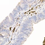 Immunohistochemistry - Anti-S100A12/CGRP Antibody (A9701) - Antibodies.com