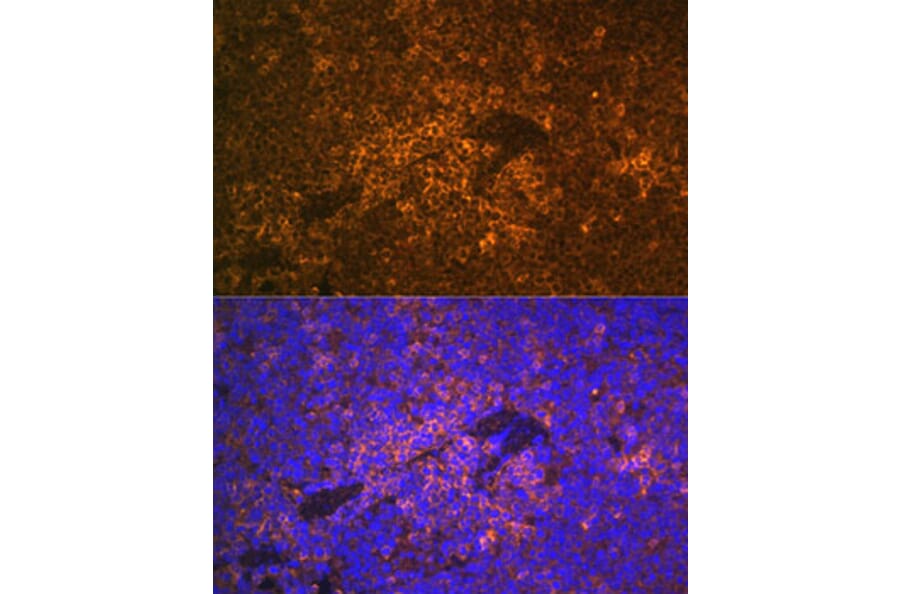 Immunofluorescence - Anti-S100A12/CGRP Antibody (A9701) - Antibodies.com