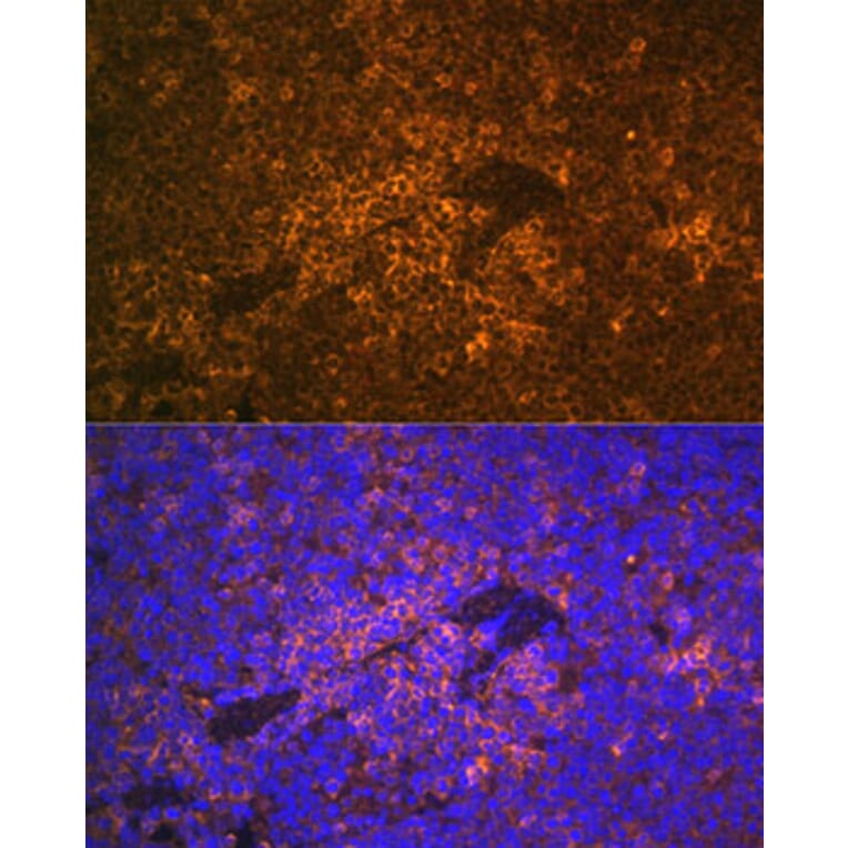 Immunofluorescence - Anti-S100A12/CGRP Antibody (A9701) - Antibodies.com