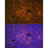 Immunofluorescence - Anti-S100A12/CGRP Antibody (A9701) - Antibodies.com