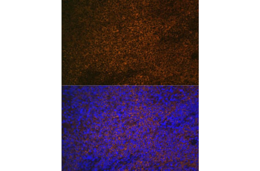 Immunofluorescence - Anti-S100A12/CGRP Antibody (A9701) - Antibodies.com