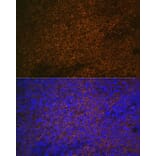 Immunofluorescence - Anti-S100A12/CGRP Antibody (A9701) - Antibodies.com