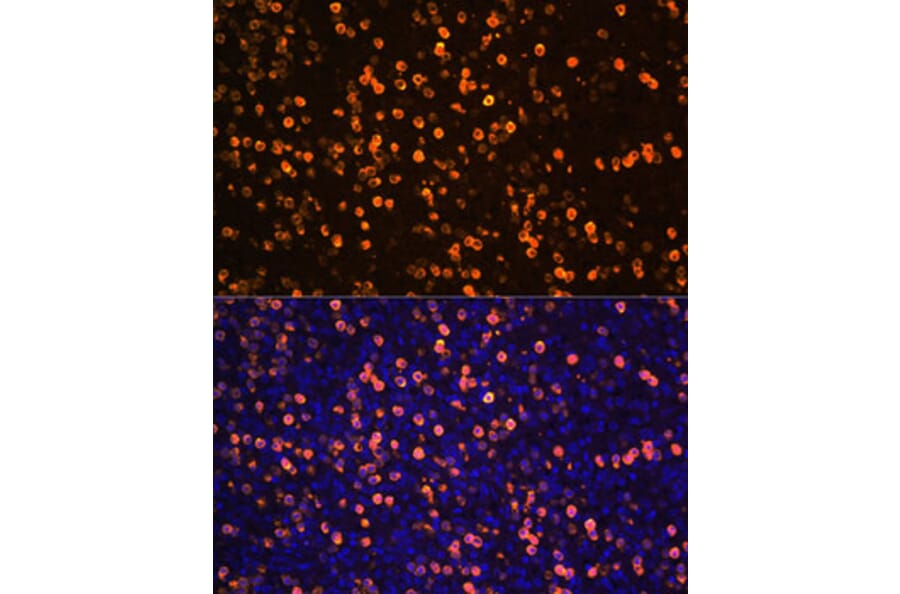 Immunofluorescence - Anti-S100A12/CGRP Antibody (A9701) - Antibodies.com