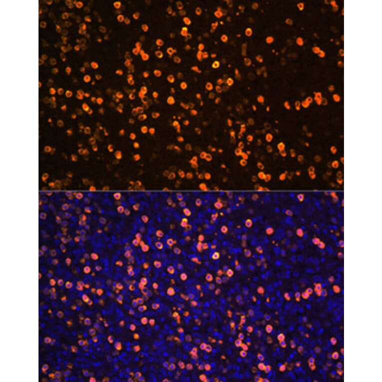 Immunofluorescence - Anti-S100A12/CGRP Antibody (A9701) - Antibodies.com