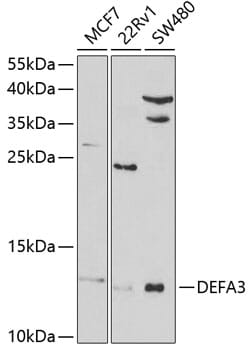 Western blot analysis of extracts of various cell lines, using Anti-DEFA3 Antibody (A5340) at 1:1,000 dilution.
Secondary antibody: Goat Anti-Rabbit IgG (H+L) (HRP) (AS014) at 1:10,000 dilution.
Lysates / proteins: 25µg per lane.
Blocking buffer: 3% non-fat dry milk in TBST.