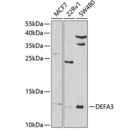 Western Blot - Anti-HP-3 Antibody (A9702) - Antibodies.com