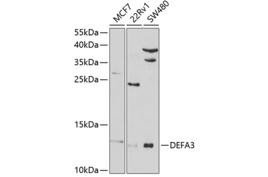Western Blot - Anti-HP-3 Antibody (A9702) - Antibodies.com