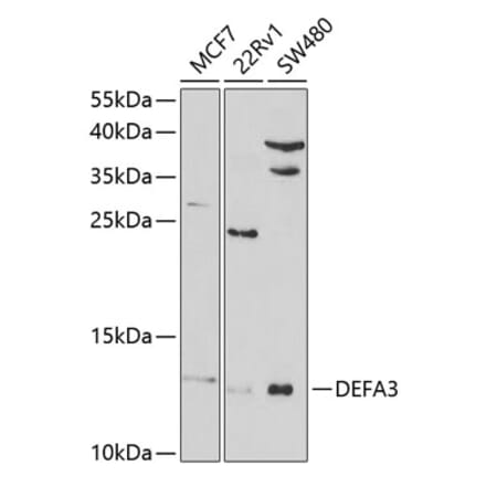 Western Blot - Anti-HP-3 Antibody (A9702) - Antibodies.com