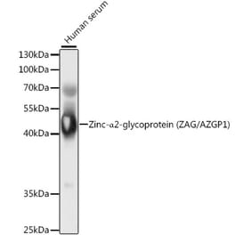 Western Blot - Anti-Zinc Alpha 2 Glycoprotein Antibody (A9703) - Antibodies.com