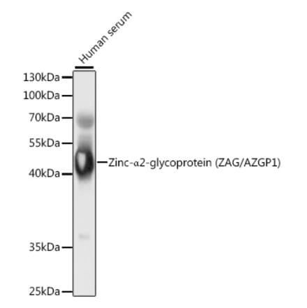 Western Blot - Anti-Zinc Alpha 2 Glycoprotein Antibody (A9703) - Antibodies.com