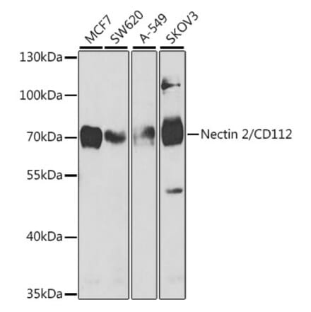 Western Blot - Anti-Nectin 2 Antibody (A9704) - Antibodies.com
