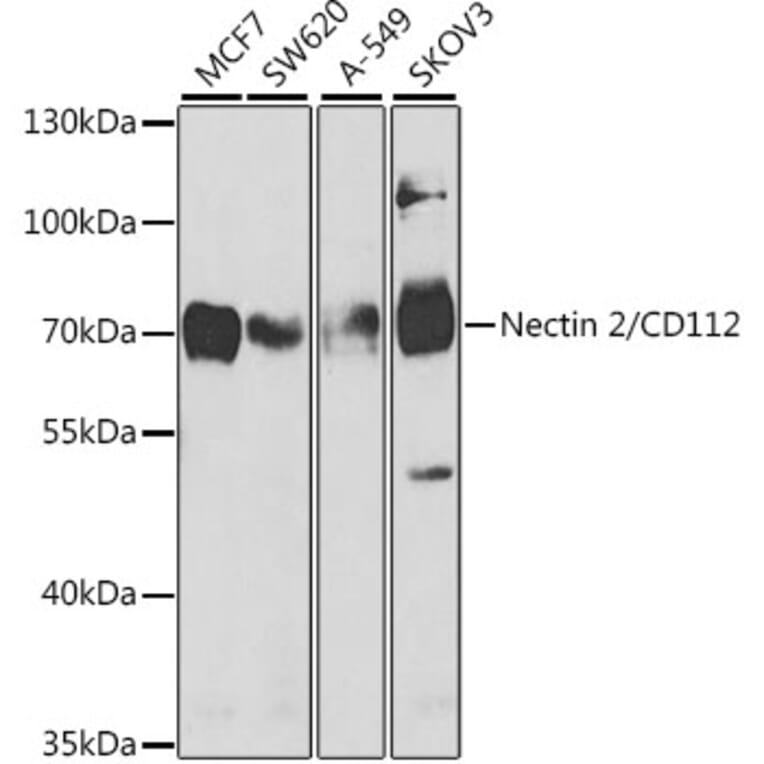 Western Blot - Anti-Nectin 2 Antibody (A9704) - Antibodies.com