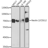 Western Blot - Anti-Nectin 2 Antibody (A9704) - Antibodies.com