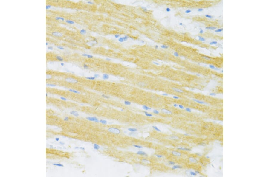 Immunohistochemistry - Anti-TYROBP Antibody (A5385) - Antibodies.com