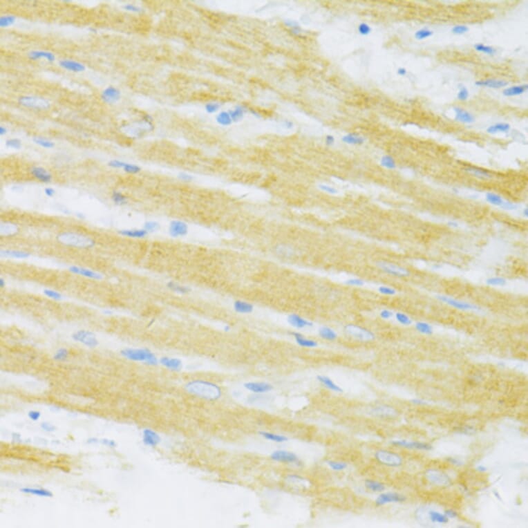Immunohistochemistry - Anti-TYROBP Antibody (A5385) - Antibodies.com