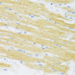 Immunohistochemistry - Anti-TYROBP Antibody (A5385) - Antibodies.com