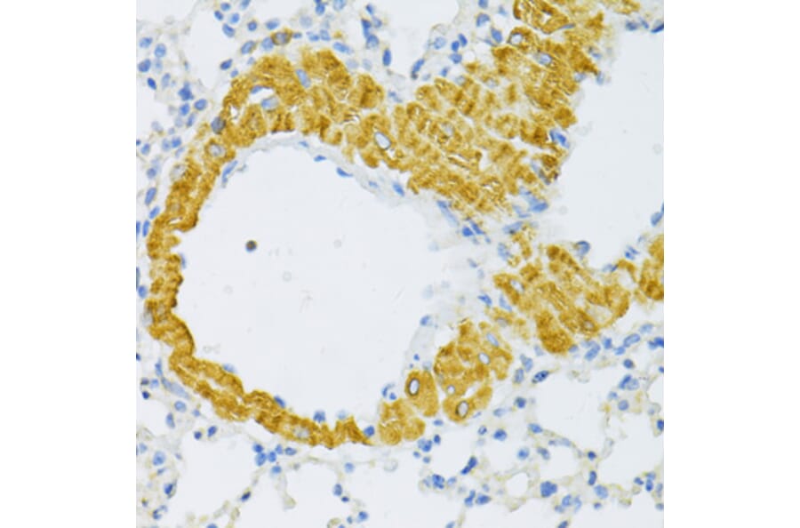 Immunohistochemistry - Anti-TYROBP Antibody (A5385) - Antibodies.com