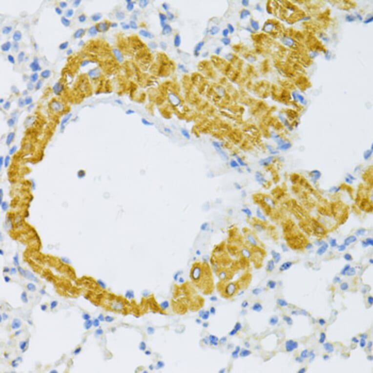 Immunohistochemistry - Anti-TYROBP Antibody (A5385) - Antibodies.com