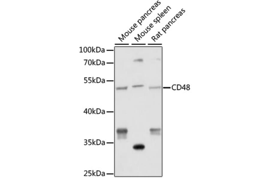Western Blot - Anti-CD48 Antibody (A9706) - Antibodies.com
