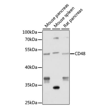 Western Blot - Anti-CD48 Antibody (A9706) - Antibodies.com