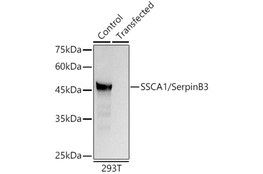 Western Blot - Anti-SerpinB3/SCCA Antibody (A9707) - Antibodies.com