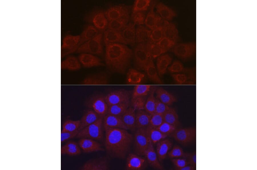 Immunofluorescence - Anti-SerpinB3/SCCA Antibody (A9707) - Antibodies.com