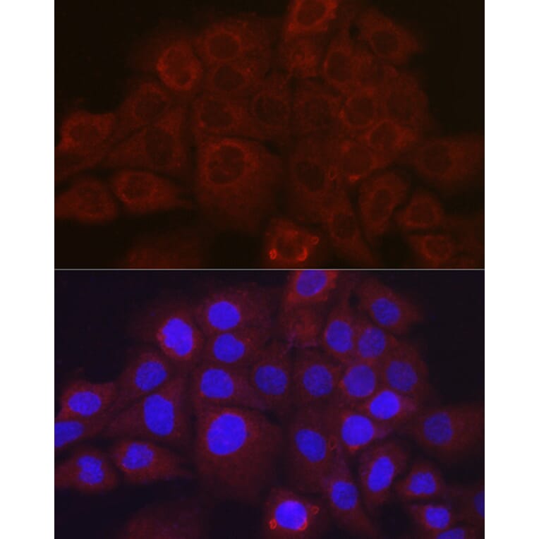 Immunofluorescence - Anti-SerpinB3/SCCA Antibody (A9707) - Antibodies.com