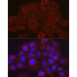 Immunofluorescence - Anti-SerpinB3/SCCA Antibody (A9707) - Antibodies.com