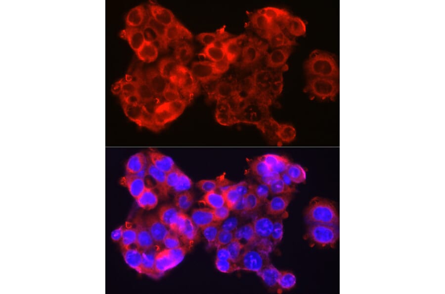 Immunofluorescence - Anti-SerpinB3/SCCA Antibody (A9707) - Antibodies.com