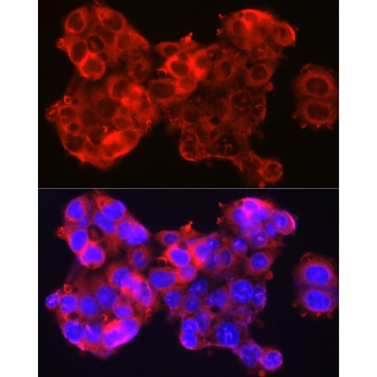 Immunofluorescence - Anti-SerpinB3/SCCA Antibody (A9707) - Antibodies.com