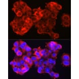 Immunofluorescence - Anti-SerpinB3/SCCA Antibody (A9707) - Antibodies.com
