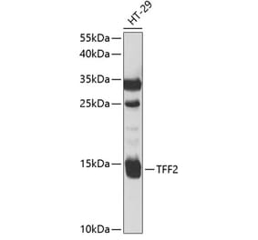 Western Blot - Anti-TFF2 Antibody (A9708) - Antibodies.com