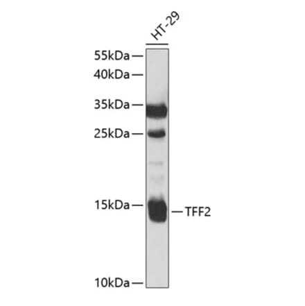 Western Blot - Anti-TFF2 Antibody (A9708) - Antibodies.com