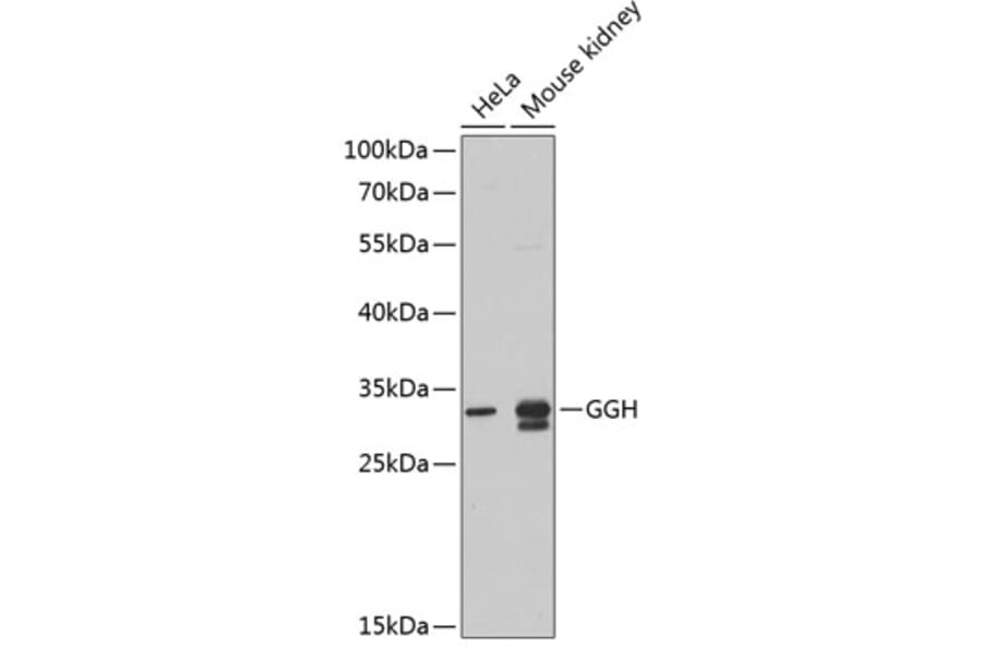 Western Blot - Anti-GGH Antibody (A9709) - Antibodies.com